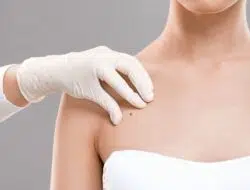 Yuk Kenali, Gejala Kanker Payudara Pada Wanita Remaja