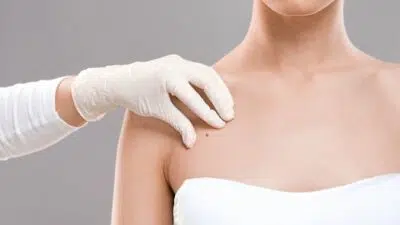 Yuk Kenali, Gejala Kanker Payudara Pada Wanita Remaja