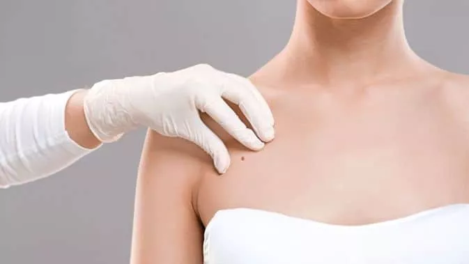 Yuk Kenali, Gejala Kanker Payudara Pada Wanita Remaja