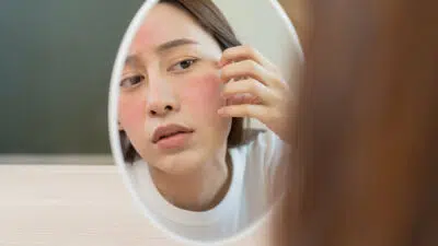Cara Keringkan Kulit Wajah yang Aman dan benar