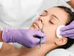 Lakukan 5 Tips Jitu Ini Untuk Hilangkan Komedo di Wajah