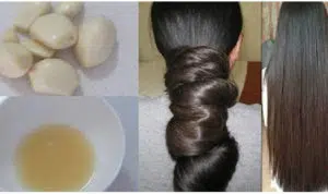 perawatan rambut rontok