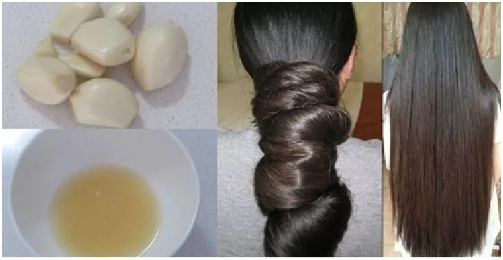Atasi Rambut Rontok dengan Bawang Putih, Caranya Mudah Lho?