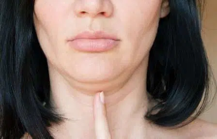 Ladies, Ini 6 Cara Samarkan Dagu Berlipat