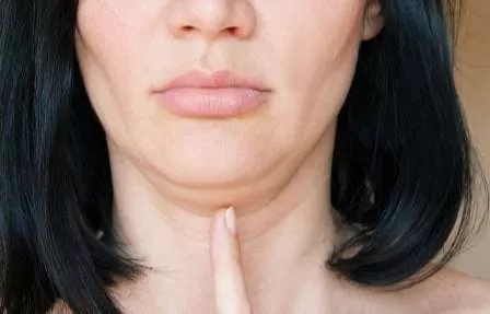 Ladies, Ini 6 Cara Samarkan Dagu Berlipat