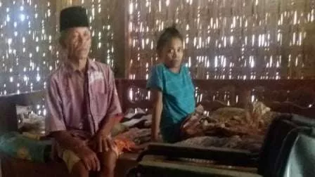 Warga Sampang Lumpuh 15 Tahun Tak Tersentuh Program Pemerintah
