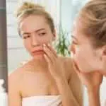 Pemilik Kulit Sensitif, Ini 6 Cara Perawatan Kecantikan yang Bisa Anda Coba