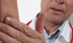 Kenali, Cara Mudah Membedakan Kelenjar Tiroid dan Getah Bening