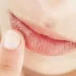 4 Cara Gunakan Minyak Kelapa untuk Bibir Kering dan Pecah-pecah
