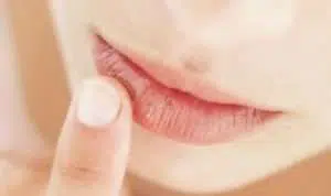 4 Cara Gunakan Minyak Kelapa untuk Bibir Kering dan Pecah-pecah