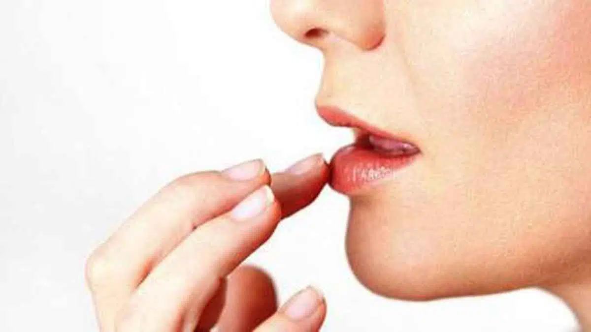 5 Cara Mujarab Atasi Jerawat di Bibir
