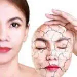 Ladies, Ini 5 Bahan Alami yang Ampuh Atasi Kulit Kering