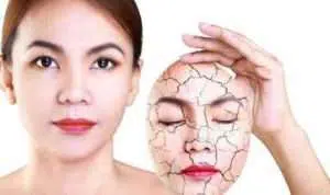 Ladies, Ini 5 Bahan Alami yang Ampuh Atasi Kulit Kering
