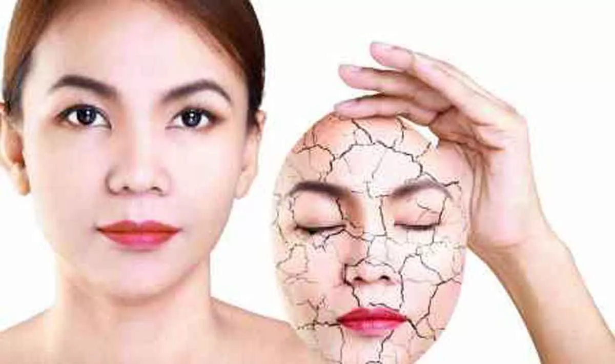 Ladies, Ini 5 Bahan Alami Yang Ampuh Atasi Kulit Kering - Portalmadura.com Ladies, Ini 5 Bahan Alami yang Ampuh Atasi Kulit Kering