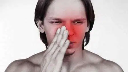 Kenali 6 Penyebab dan Cara Penanganan Penyakit Sinusitis-min