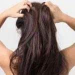 Yuk, Intip Cara Unik Atasi Iritasi Kulit Kepala Akibat Perawatan Rambut