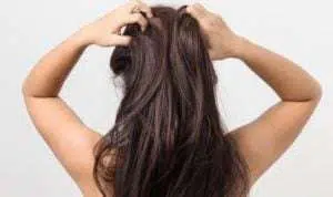 Yuk, Intip Cara Unik Atasi Iritasi Kulit Kepala Akibat Perawatan Rambut