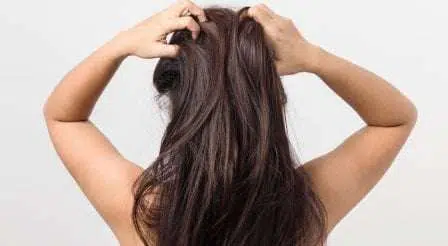 Yuk, Intip Cara Unik Atasi Iritasi Kulit Kepala Akibat Perawatan Rambut
