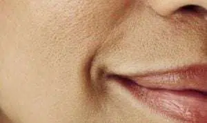 Ladies, 3 Cara Merawat Kulit di Wajah agar Pori-pori Tidak Besar