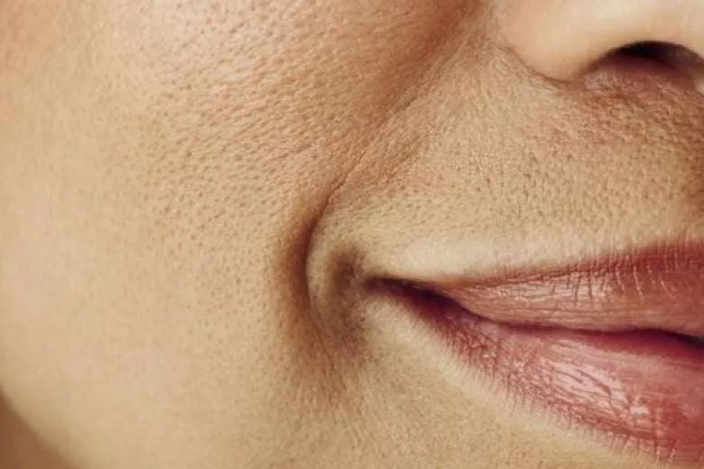 Ladies, 3 Cara Merawat Kulit di Wajah agar Pori-pori Tidak Besar