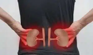 7 Kebiasaan Buruk yang Bisa Rusak Ginjal
