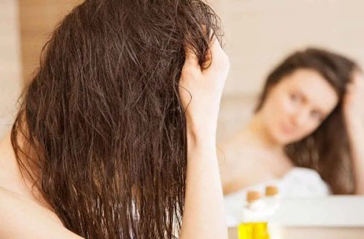 Dampak Negatif Oles Vitamin Rambut di Kulit Kepala