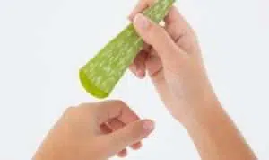 Gel Lidah Buaya, Cara Ampuh Atasi Sunburn pada Kulit