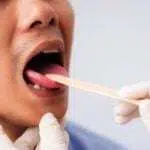 Hati-hati, Bintik Kecil di Lidah Bisa Sebabkan Masalah Kesehatan