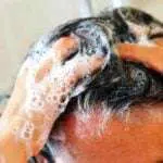Jangan Sepelekan, 3 Kesalahan Keramas Ini Bisa Sebabkan Ketombe