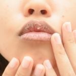 3 Cara Mengatasi Bibir Kering Selama Ramadan
