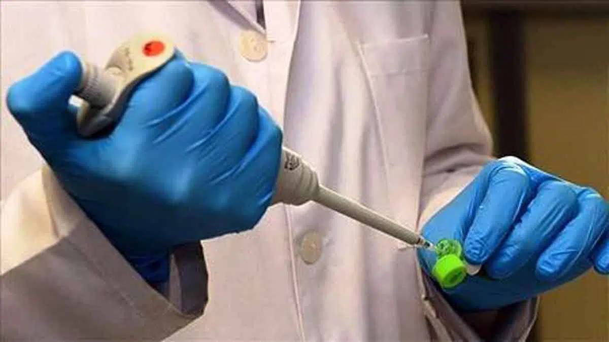 Virus Human Monkeypox di Singapura, Pemerintah RI perketat pemeriksaaan di pelabuhan dan bandara