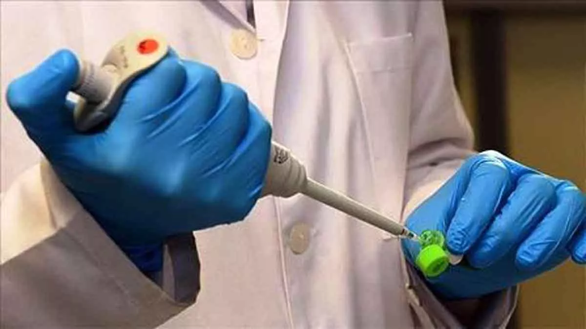 Virus Human Monkeypox di Singapura, Pemerintah RI perketat pemeriksaaan di pelabuhan dan bandara