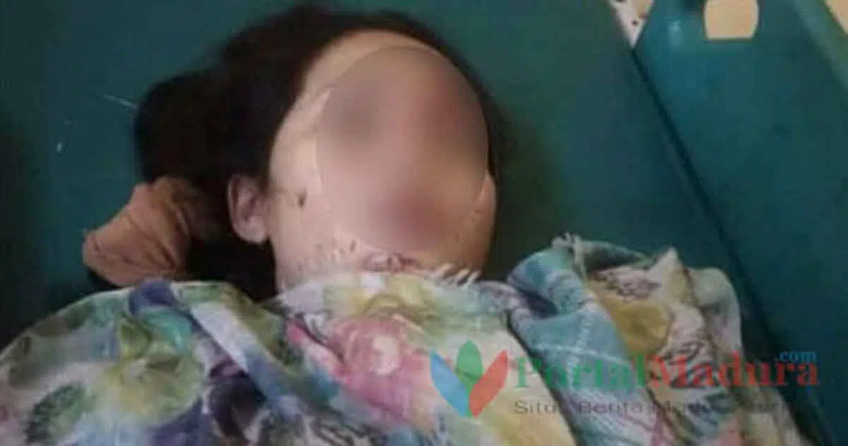 Naik Motor Sambil Main HP, Ibu Muda Tewas Kecelakaan di Madura