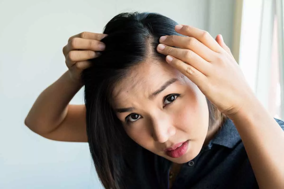 Begini 5 Tips Menghilangkan Jerawat Di Sekitar Kulit Rambut - Portalmadura.com Begini 5 Tips Menghilangkan Jerawat di Sekitar Kulit Rambut