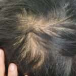 Rambut Tipis? Begini 5 Tips yang Tepat saat Mencucinya