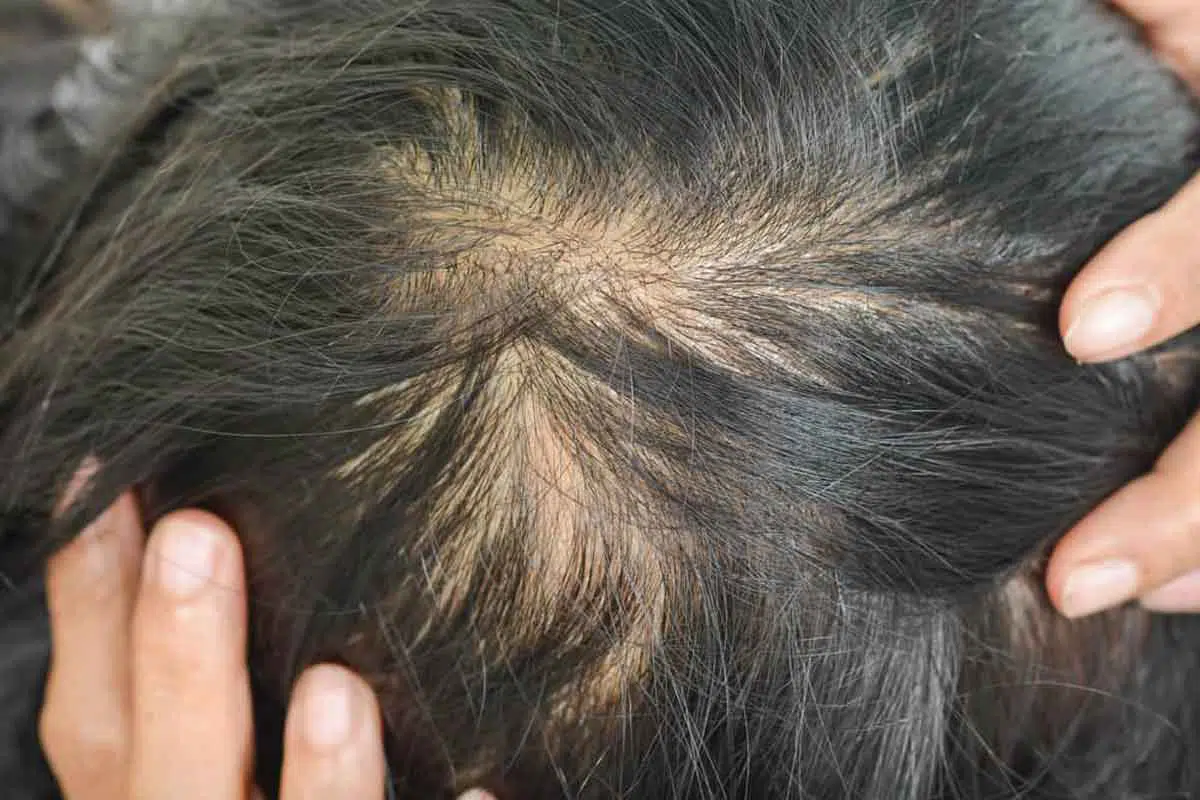 Rambut Tipis? Begini 5 Tips yang Tepat saat Mencucinya