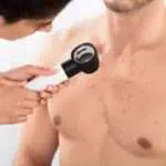 Kenali Penyebabnya saat Jerawat Muncul di Dada?