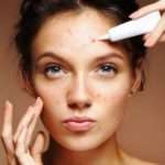 Perbedaan Jerawat Batu dan Rosacea yang Harus Anda Ketahui