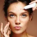 Perbedaan Jerawat Batu dan Rosacea yang Harus Anda Ketahui