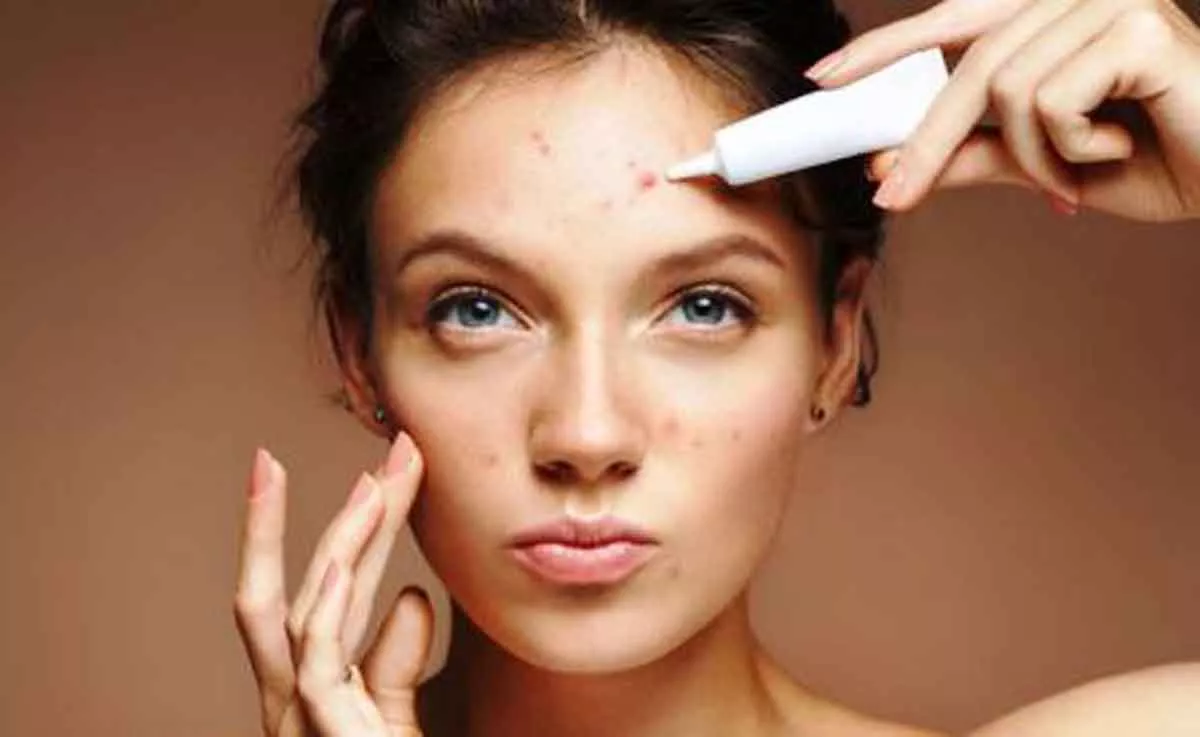 Perbedaan Jerawat Batu dan Rosacea yang Harus Anda Ketahui