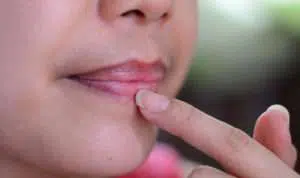 Trik Mudah Mencerahkan Bibir yang Gelap