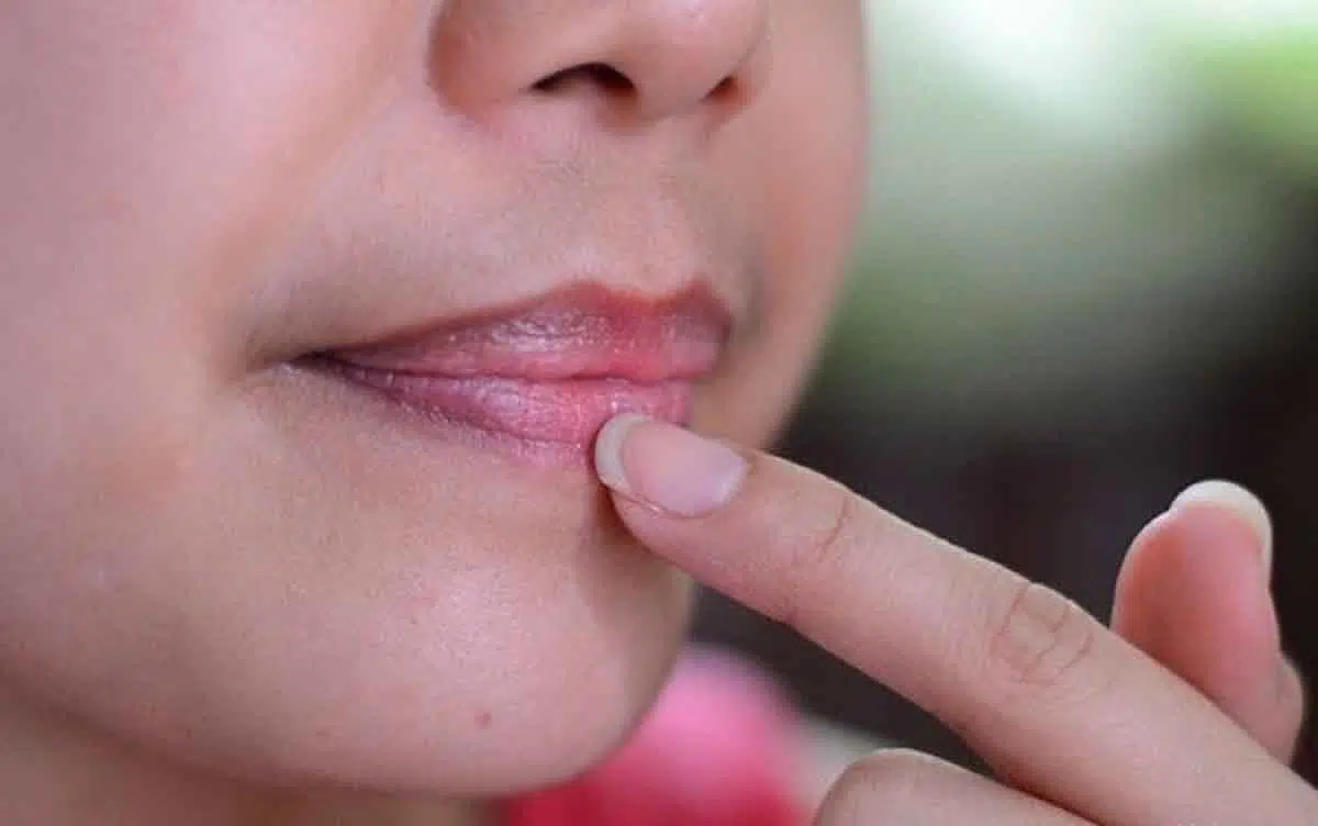 Trik Mudah Mencerahkan Bibir yang Gelap