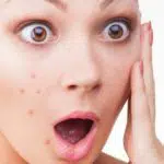 Malas Gunakan Sunscreen, Ini 5 Dampaknya Bagi Kulit