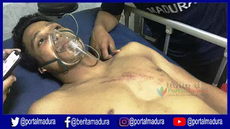 Alami Benturan Keras, Muhammad Ridho Dilarikan ke RS dan Sesak Nafas