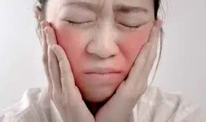 Awas, Ini 5 Perawatan Wajah yang Perlu Dihindari