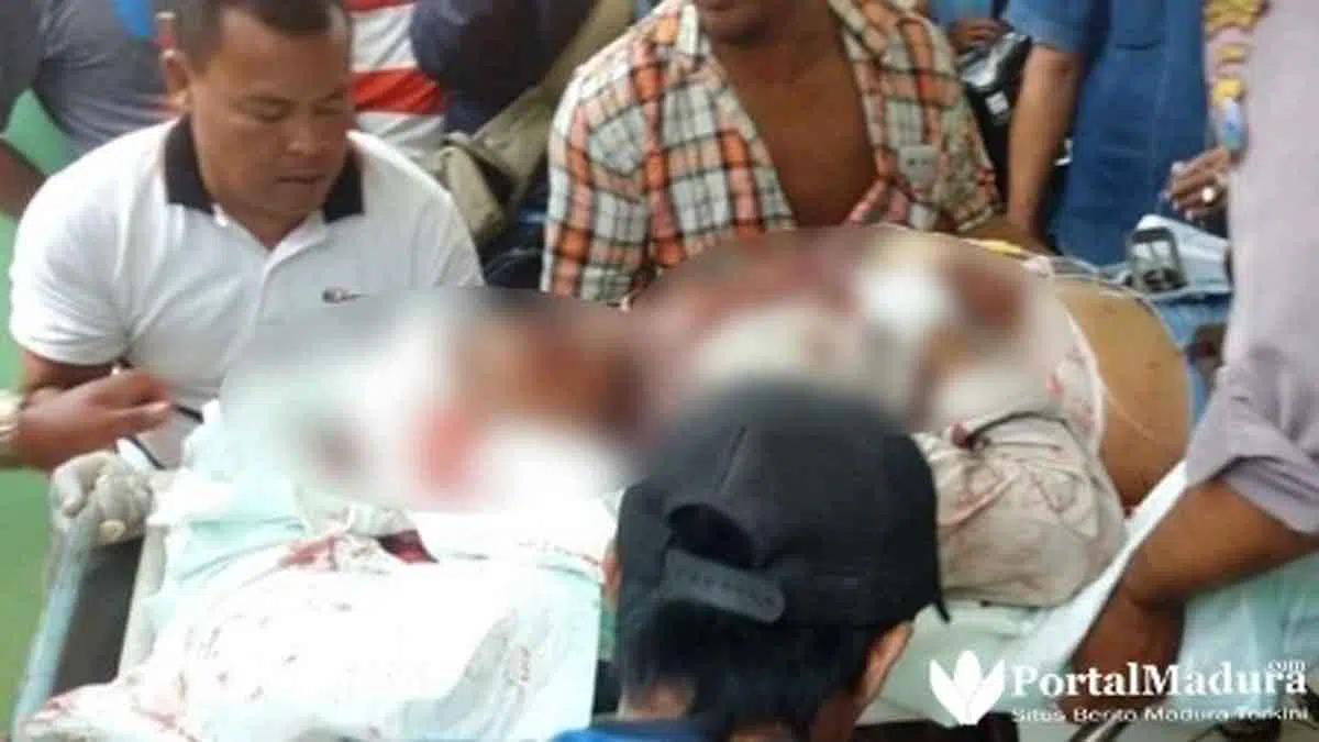 Gegara Sepele, Warga Bangkalan Dibacok Delapan Orang
