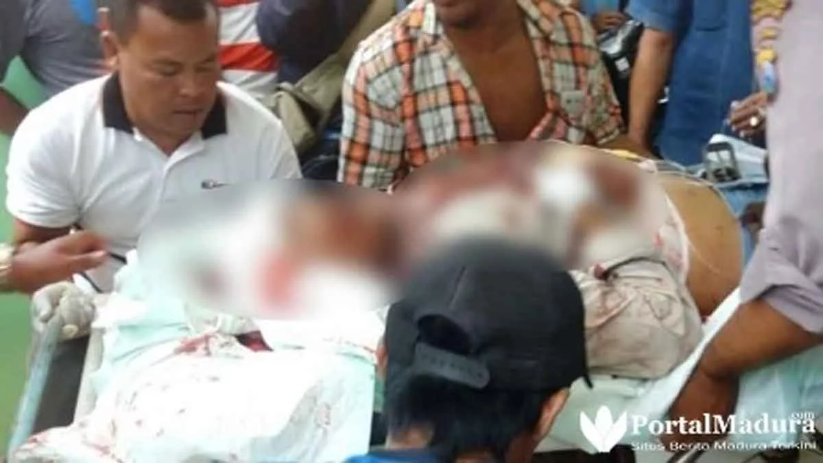 Gegara Sepele, Warga Bangkalan Dibacok Delapan Orang