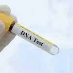 Pentingnya Lakukan Tes DNA Bagi Perawatan Kecantikan