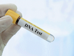Pentingnya Lakukan Tes DNA Bagi Perawatan Kecantikan