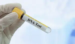 Pentingnya Lakukan Tes DNA Bagi Perawatan Kecantikan
